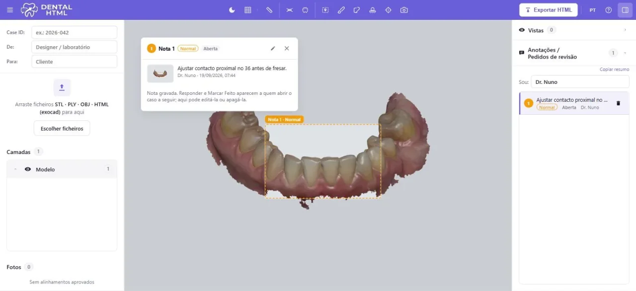Dental HTML viewer showing a 3D case with occlusal contact colours and an open note