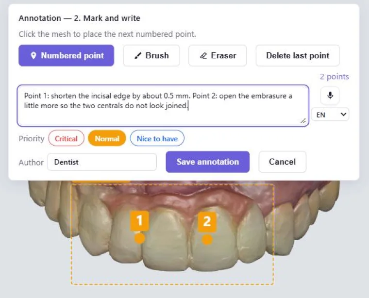 Writing a note: points on the tooth, priority, and the microphone to dictate
